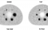 <p>山西医科大学第一医院PET/CT科研成果发表于Scientific Reports杂志</p>
